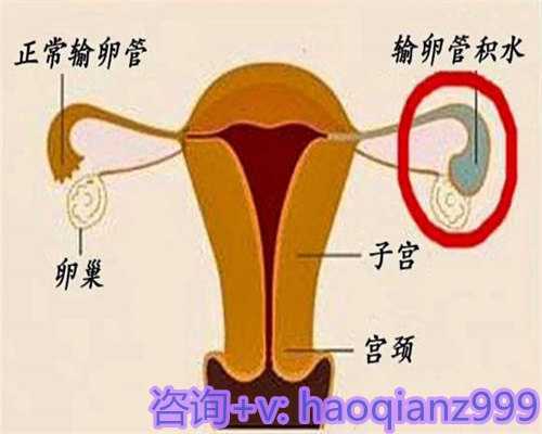 天津代怀助孕妈妈产后上火：清热降火秘诀与代生服务费用探讨