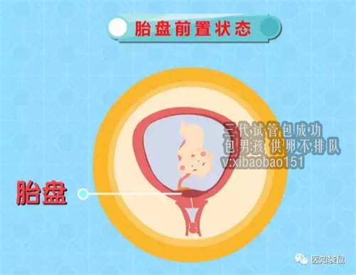 天津代怀机构怀孕妈妈,孕妇的痔疮的5个原因